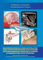 Малоинвазивные вмешательства под ультразвуковым контролем при заболеваниях желчного пузыря и поджелудочной железы