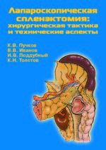 Лапароскопическая спленэктомия: хирургическая тактика и технические аспекты