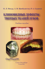 Клиновидные дефекты твердых тканей зубов