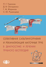 Селективная сальпингография и реканализация маточных труб в диагностике и лечении трубного бесплодия