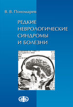 Редкие неврологические синдромы и болезни (наблюдения из практики)