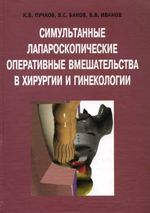 Симультанные и лапароскопические оперативные вмешательства в хирургии и гинекологии