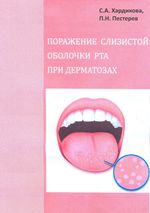 Поражение слизистой оболочки рта при дерматозах