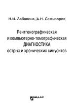 Рентгенографическая и компьютерно-томографическая диагностика острых и хронических синуситов