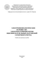 Электрофизиологические основы ЭКГ. Электропатофизиология  ишемии и отдельных нарушений сердечного ритма