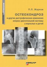 Остеохондроз и другие дистрофические изменения опорно-двигательной системы у взрослых и детей