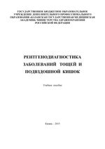 Рентгенодиагностика заболеваний тощей и  подвздошной кишки