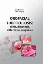 Orofacial tuberculosis: clinic, diagnosis, differential diagnosis