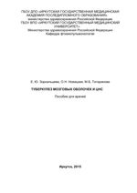 Туберкулез мозговых оболочек и ЦНС