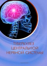 Туберкулез центральной нервной системы