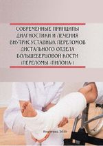 Современные принципы диагностики и лечения внутрисуставных переломов дистального отдела большеберцовой кости (переломы «пилона»)