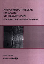 Атеросклеротические поражения сонных артерий: клиника, диагностика, лечение