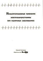 Инфарктоподобные изменения электрокардиограммы при различных заболеваниях