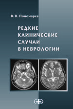 Редкие клинические случаи в неврологии (случаи из практики)