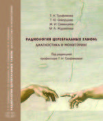 Радиология церебральных глиом: диагностика и мониторинг