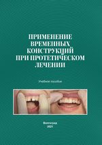 Применение временных конструкций при протетическом лечении