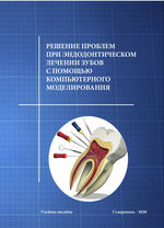 Решение проблем при эндодонтическом лечении зубов с помощью компьютерного моделирования