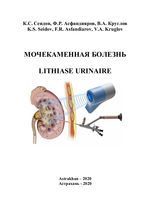 Lithiase urinaire