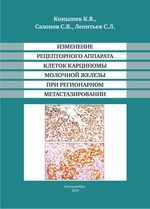 Изменение рецепторного аппарата клеток карциномы молочной железы при регионарном метастазировании