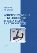 Конструирование искусственных зубных рядов в артикуляторе