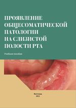 Проявление общесоматической патологии на слизистой полости рта
