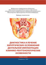 Диагностика и лечение хирургических осложнений дентальной имплантации: клинико-рентгенологические особенности