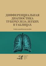 Дифференциальная диагностика туберкулеза в таблицах
