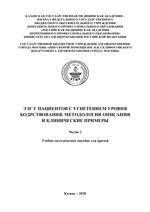 ЭЭГ у пациентов с угнетением уровня бодрствования. Методология описания и клинические примеры Ч. 2