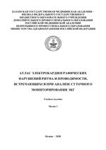 Атлас электрокардиографических нарушений  ритма и проводимости, встречающихся  при анализе суточного мониторирования ЭКГ в 2 ч. Часть 1