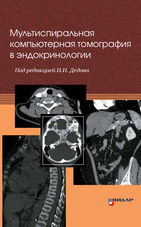 Мультиспиральная компьютерная томография в эндокринологии