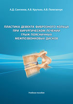 Пластика дефекта фиброзного кольца при хирургическом лечении грыж поясничных межпозвонковых дисков