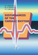 Disturbances of the cardiac rhythm