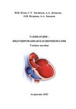 Тахикардия – индуцированная кардиомиопатия