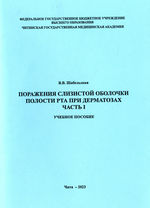 Поражения слизистой оболочки полости рта при дерматозах. Часть I