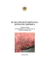 Вульгарная пузырчатка. Дерматит Дюринга