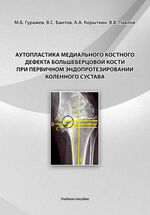 Аутопластика медиального костного дефекта большеберцовой кости при первичном эндопротезировании коленного сустава