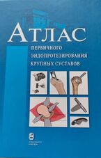 Атлас первичного эндопротезирования крупных суставов