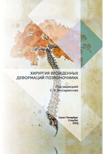 Хирургия врожденных деформаций позвоночника
