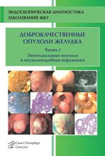 Доброкачественные опухоли желудка. Ч. 1. Эпителиальные опухоли и опухолеподобные поражения