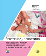 Рентгенодиагностика заболеваний легких у новорожденных и недоношенных детей