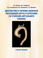Диагностика и лечение аневризм восходящей аорты в сочетании со стенозом аортального клапана