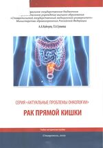 Рак прямой кишки