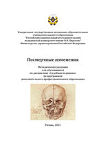 Посмертные изменения