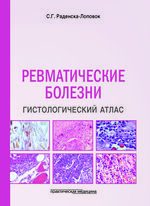 Ревматические болезни