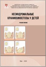 Несиндромальные краниосиностозы у детей