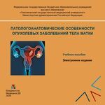 Патологоанатомические особенности опухолевых заболеваний тела матки