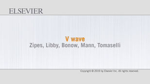Обложка: Видео 10.1. V-волна. Выраженная v-волна видна на левой половине шеи пациента с тяжелой трикуспидальной регургитацией
