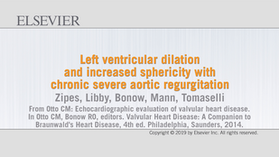 Обложка: Видео 68.2A Расширение левого желудочка и увеличение его сферичности при хронической тяжелой аортальной регургитации
