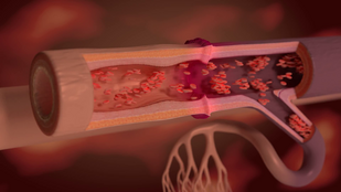Обложка: 2. Видео_Компьютерное моделирование и анимация артериального притока и венозного оттока в реперфузируемом кожнофасциальном лоскуте