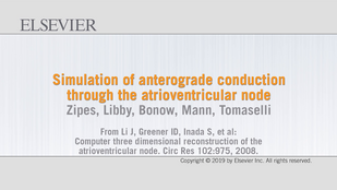 Обложка: Видео 34.1. Симуляция антероградного проведения через атриовентрикулярный узел...см. далее стр. XXi